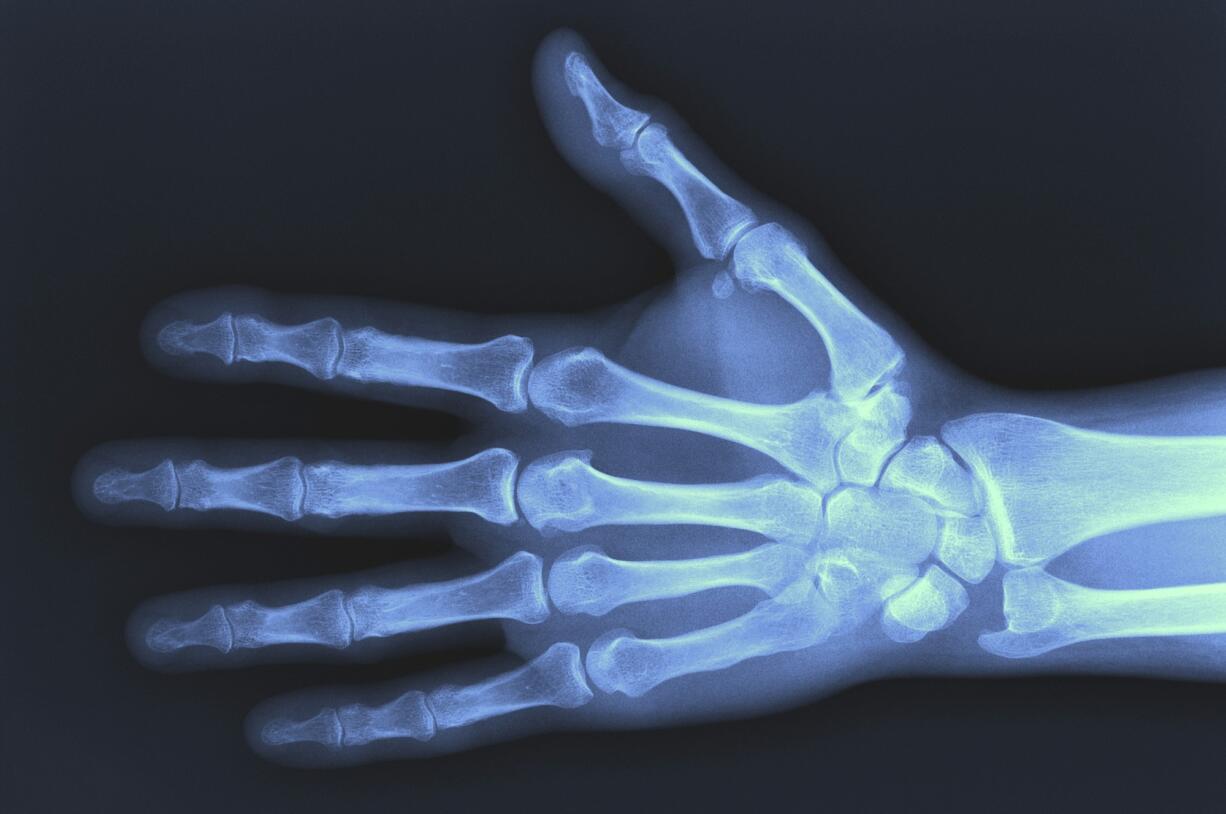 The bones and joints of a human hand.