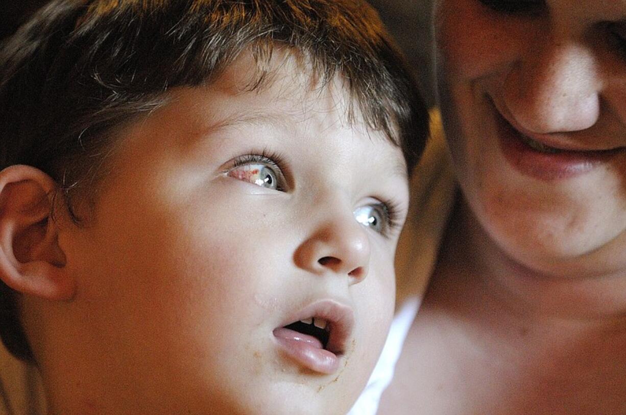 Jesse Matlock, 4, sits with his mother, Tasha Gaul, at their Vancouver home Tuesday. Jesse had surgery last week to correct his wandering right eye. The surgeon mistakenly operated on Jesse's left eye.