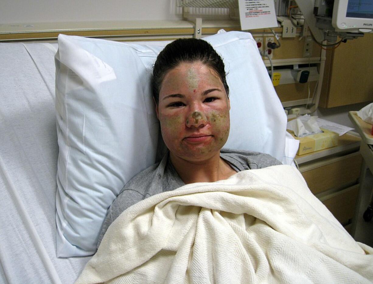 Legacy Health released this photo of Bethany Storro taken after the Monday attack near Esther Short Park.