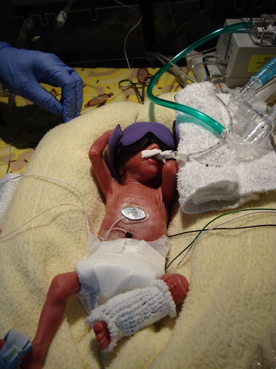 Preemie ventilator best sale