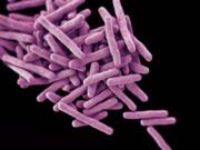 This 3-D illustration depicts a cluster of rod-shaped drug-resistant Mycobacterium tuberculosis bacteria, the pathogen responsible for causing the disease tuberculosis.