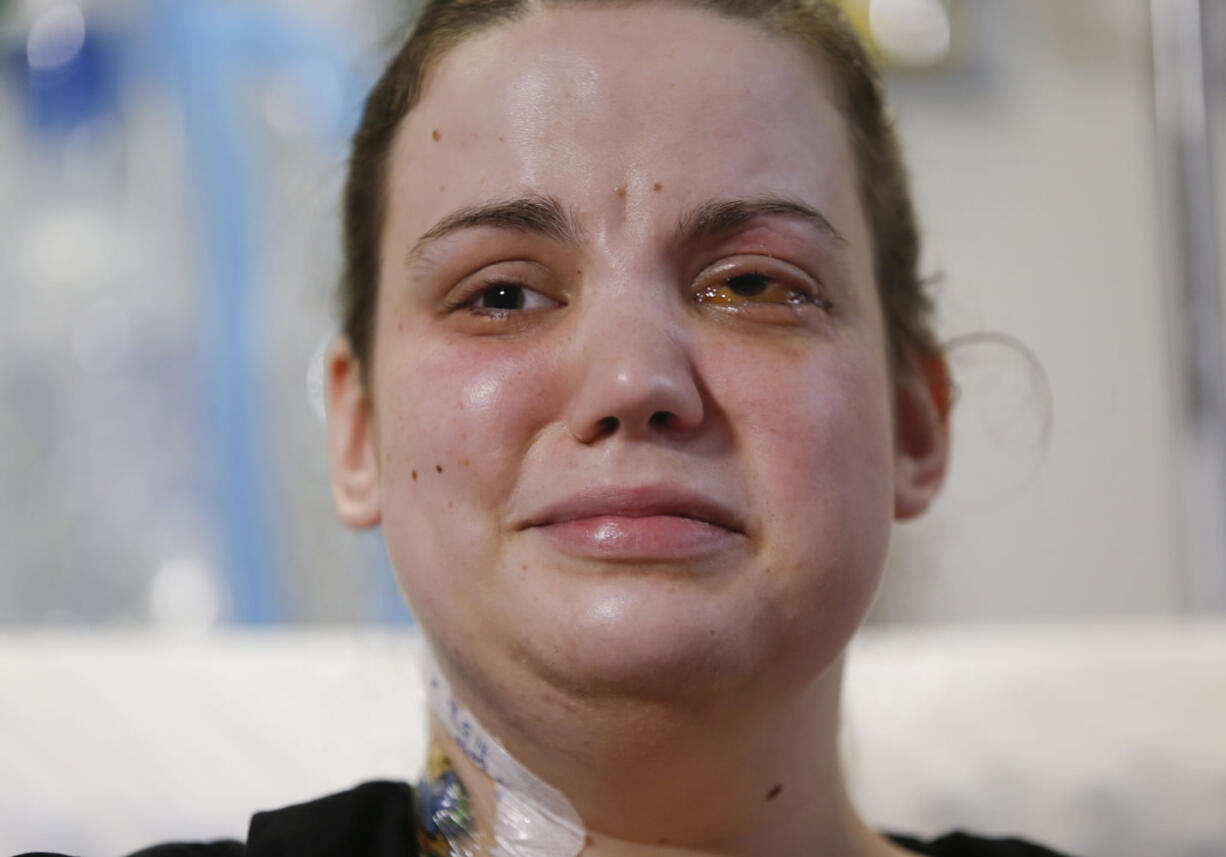 Washington mudslide survivor Amanda Skorjanc, 25, talks to the media while sitting in her hospital bed on Wednesday.