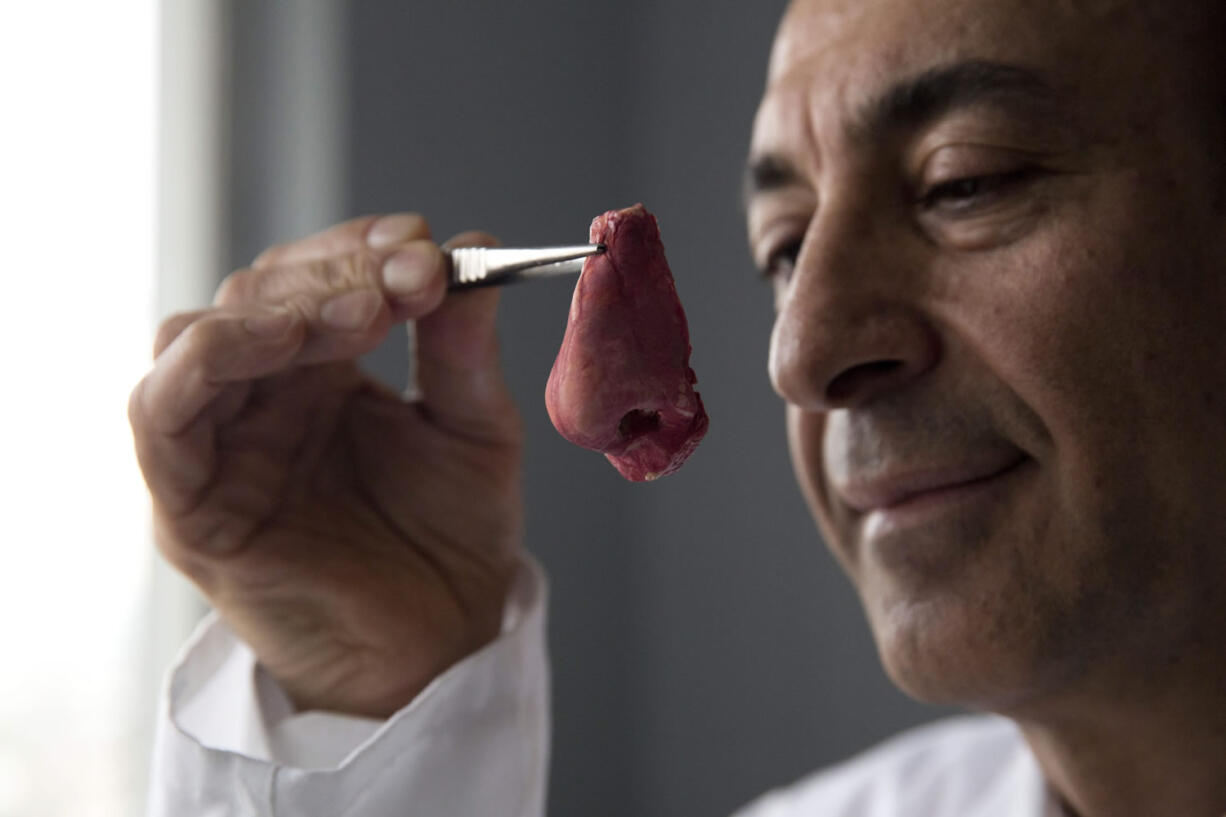 Professor Alexander Seifalian holds a synthetic polymer nose March 31 at his research facility in the Royal Free Hospital in London.