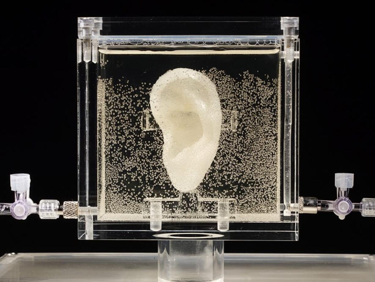 An ear made of human cells grown from samples provided by a distant relative of Dutch artist Vincent van Gogh is on display at the center for art and media in Karlsruhe, Germany.