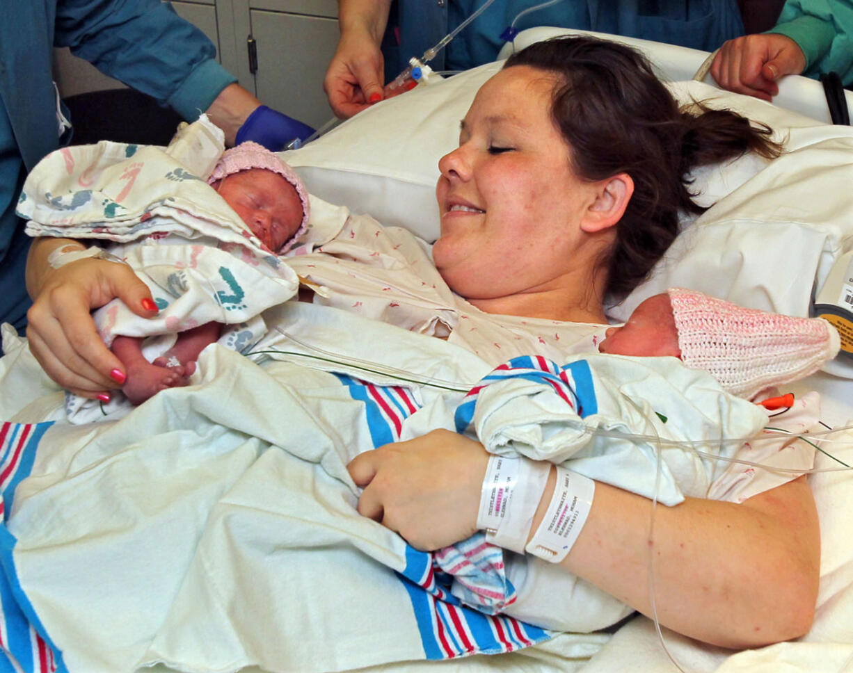 Sarah Thistlethwaite holds her twin daughters, Jenna and Jillian, after her delivery of the monoamniotic twin girls on May 9 at Akron General Hospital in Akron, Ohio.