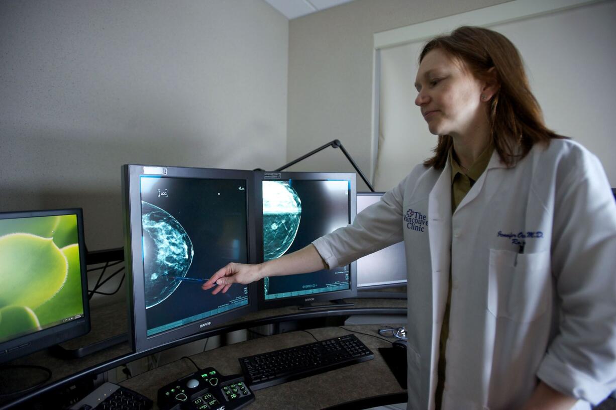 Dr. Jennifer Ochsner, a radiologist at The Vancouver Clinic, reviews the mammogram of a woman who is younger than 50 and was diagnosed with breast cancer.