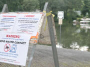 Signs posted at various entry points around the contiguous Lacamas and Round lakes in Camas warn people to avoid contact with the water. On Friday, Clark County Public Health announced that blue-green algae was discovered in Lacamas Lake through routine testing.