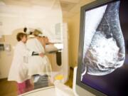 Leslie Dykman, lead mammography technologist at PeaceHealth Southwest Medical Center's Kearney Breast Center, performs a 3-D mammogram on a patient in March 2012.