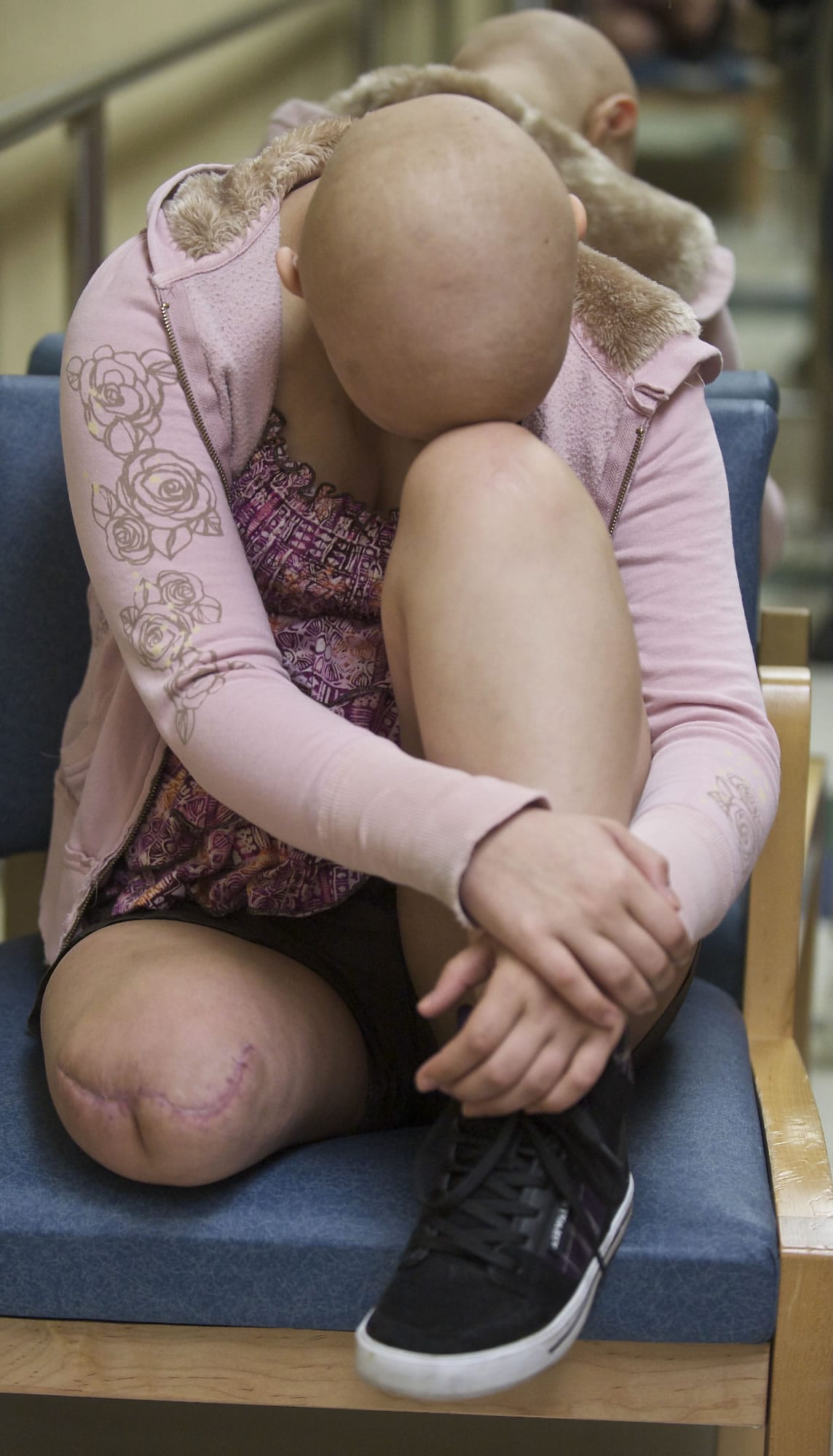 Caitlyn Lippolis rests after working out her new leg prosthetic leg last month at Artisan Technologies in Tualatin, Ore.