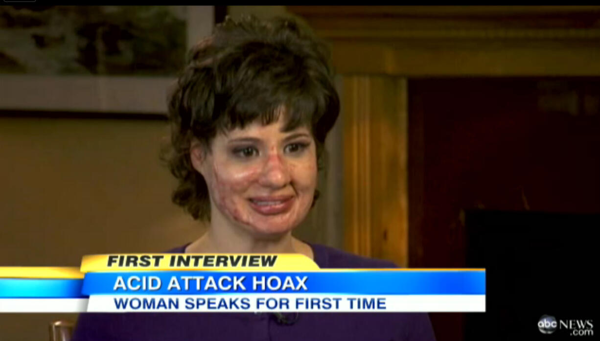 Bethany Storro, 30, of Vancouver removed a clear compression mask during an appearance March 4 on &quot;Good Morning America.&quot; She discussed why she burned her face with drain cleaner and then claimed she was attacked.