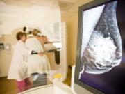 Leslie Dykman, lead mammography technologist at PeaceHealth Southwest Medical Center's Kearney Breast Center, uses new 3-D technology to perform a mammogram on a patient Monday. The 3-D mammograms take multiple photos of the breast, tissue-layer by tissue-layer.