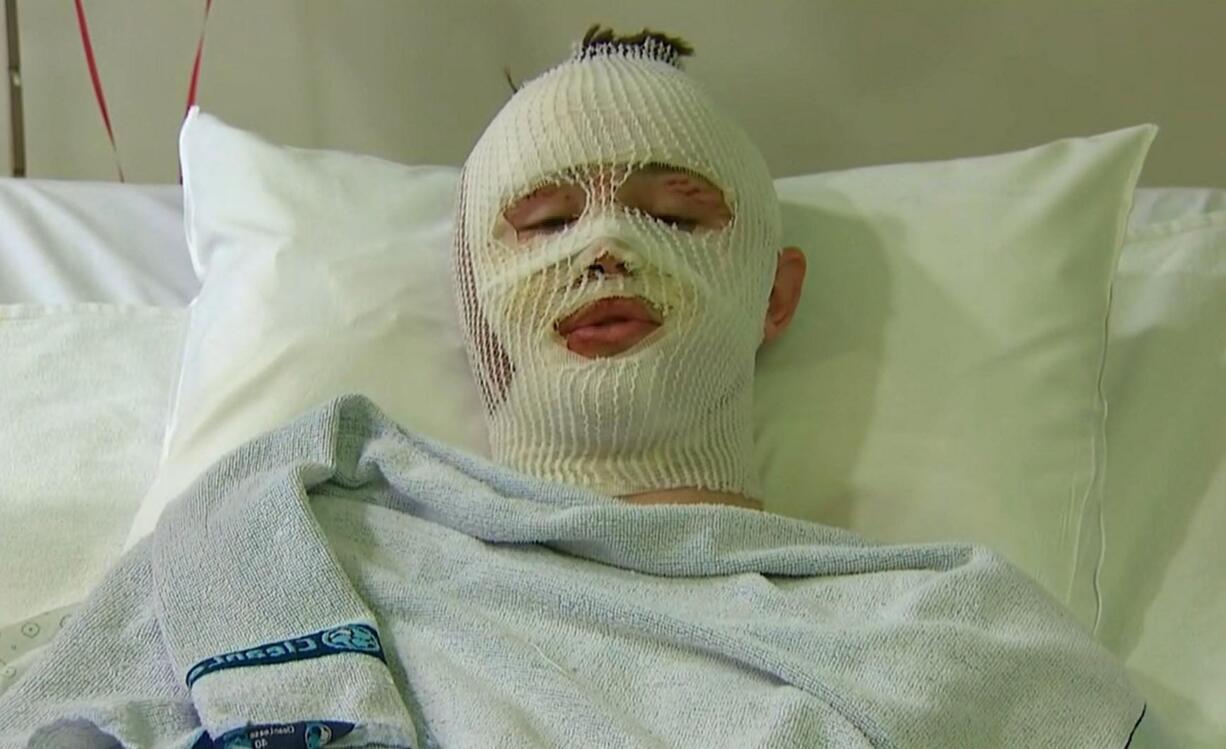 Mason Wells, an American survivor of the attacks in Belgium, answers questions during an interview Friday in a hospital in Ghent, Belgium.