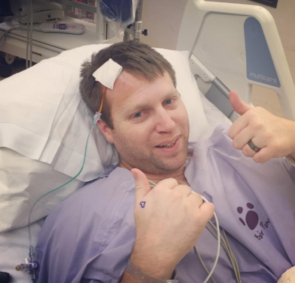 Tony MacDougall, 29, of Vancouver underwent an internal ventriculostomy earlier this month. The procedure created a hole to allow his cerebral spinal fluid to drain.
