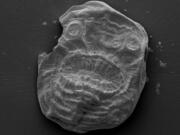 The fossil of Saccorhytus, a microscopic, bag-like sea creature that lived about 540 million years ago. It is the oldest known ancestor of humans.