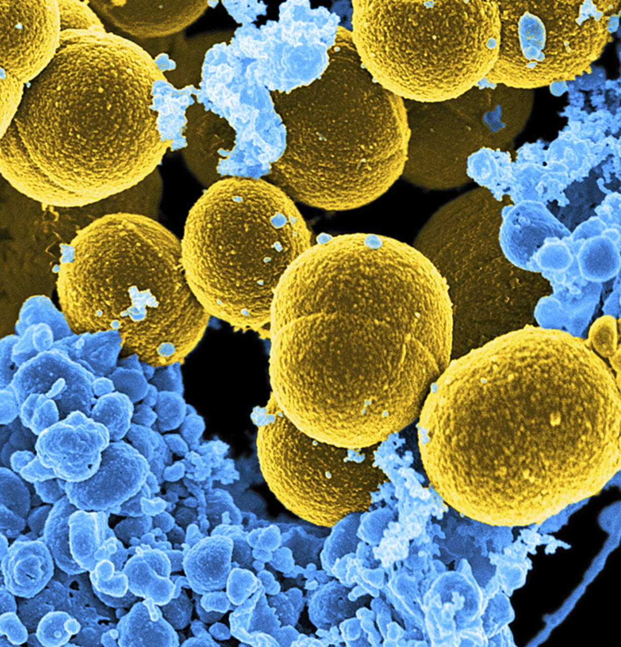 This digitally colorized microscope image shows Staphylococcus aureus bacteria in yellow. New research found protective bacteria in healthy skin produce natural antibiotics that can guard against disease-causing Staph aureus.