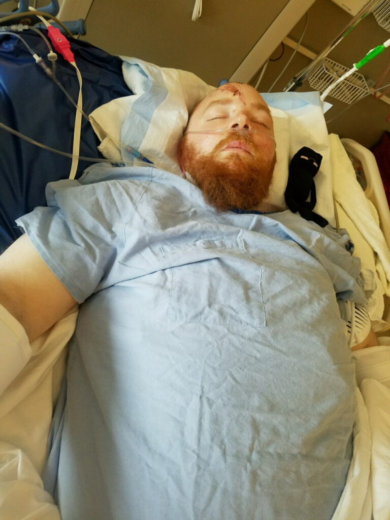 Paul Adams, 34, who was seriously injured when he was struck by a hit-and-run driver as he walked along the road in Vancouver’s Truman neighborhood, recovers at PeaceHealth Southwest Medical Center in Vancouver.