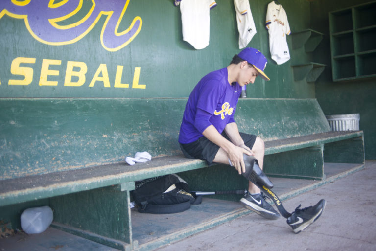 Daren Manheimer puts on his prosthetic leg before a game against R.A. Long.