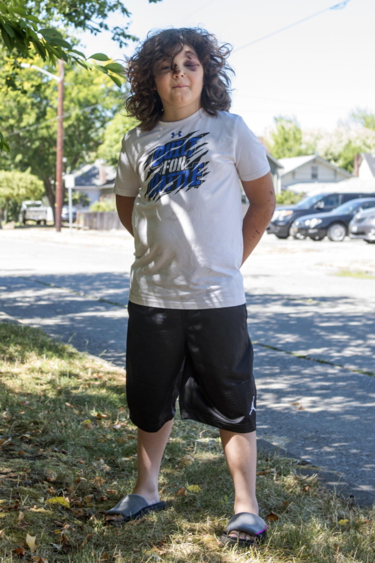 Zaiden Cochran, 10, credits a helmet he’d only had for a short time with saving his life and allowing him to recover so quickly from a catastrophic bike crash in Marysville.