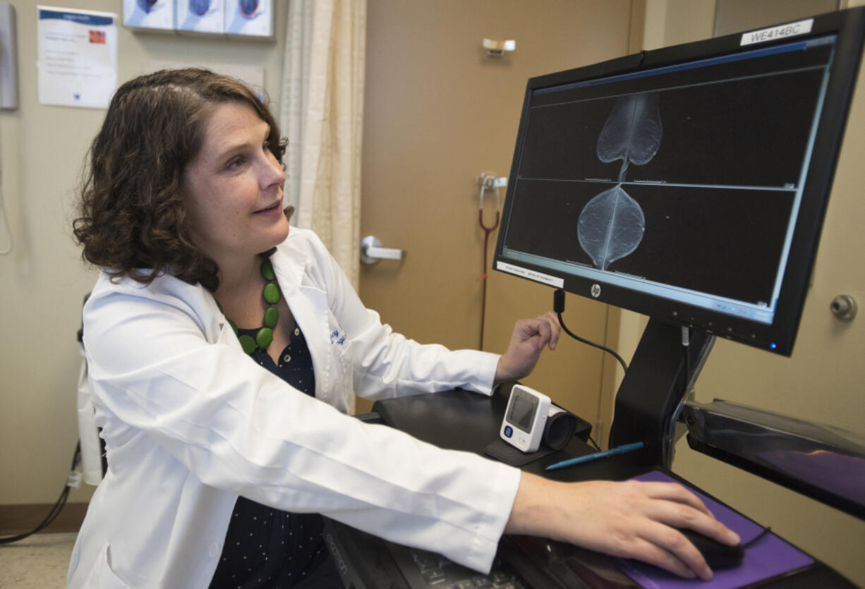 Dr. Cory Donovan looks over mammogram images Thursday morning at Legacy Good Samaritan Medical Center in Portland. Donovan, a breast surgical oncologist, will soon split her time at Good Sam and Legacy Salmon Creek Medical Center.