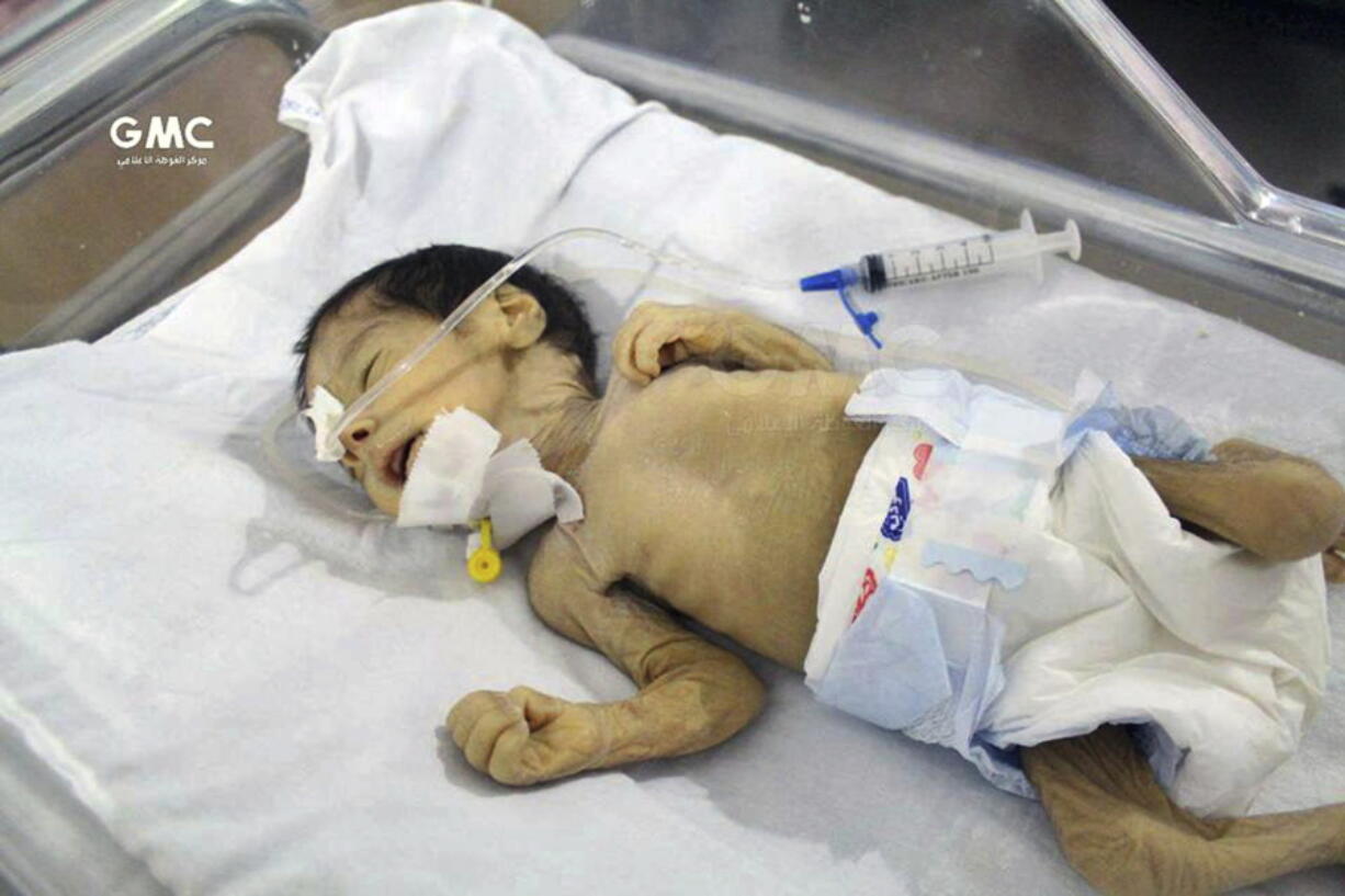 This photo provided on Saturday, Oct. 21, 2017 by the Syrian anti-government activist group Ghouta Media Center, which has been authenticated based on its contents and other AP reporting, shows an undernourished infant receiving an IV in an incubator in a hospital in Ghouta, near Damascus, Syria. The United Nations Children agency says the worst malnutrition rate since the start of the Syria conflict nearly seven years ago has been recorded in a rebel-held suburb of Damascus, besieged since mid-2013.