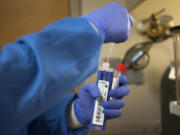 Lab assistant Melissa Cornelison tests nasal swabs for influenza on Tuesday afternoon at PeaceHealth Southwest’s Inpatient Laboratory in Vancouver. The hospital is seeing an influx of patients with the flu.