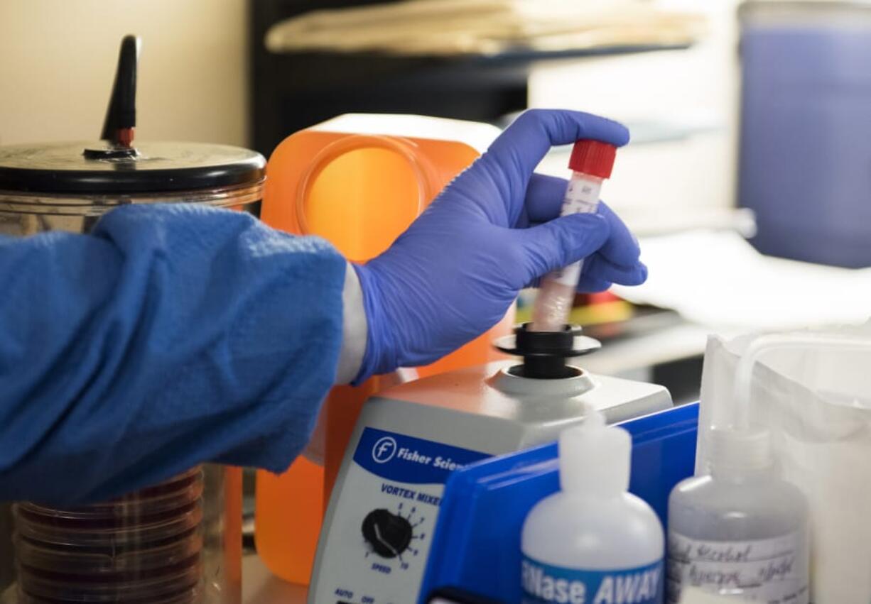 Lab assistant Melissa Cornelison tests nasal swabs for influenza recently at PeaceHealth Southwest’s Inpatient Laboratory in Vancouver. The hospital is seeing an influx in patients with the flu.