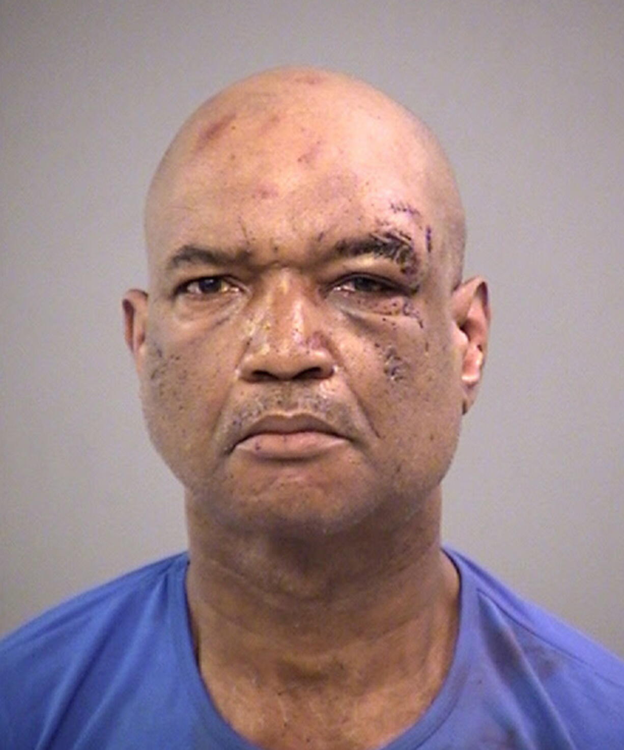 CORRECTS SOURCE TO MARION COUNTY JAIL - Gary Madison of Indianapolis is seen in an undated booking photo released Sunday, April 8, 2018, by the Marion County Jail. Madison faces three preliminary charges of battery by means of a deadly weapon. Three men suffered severe cuts when a knife-wielding Madison attacked a crowd of people in downtown Indianapolis Saturday afternoon, April 7, after being told to stop playing a siren on a bullhorn, authorities said.