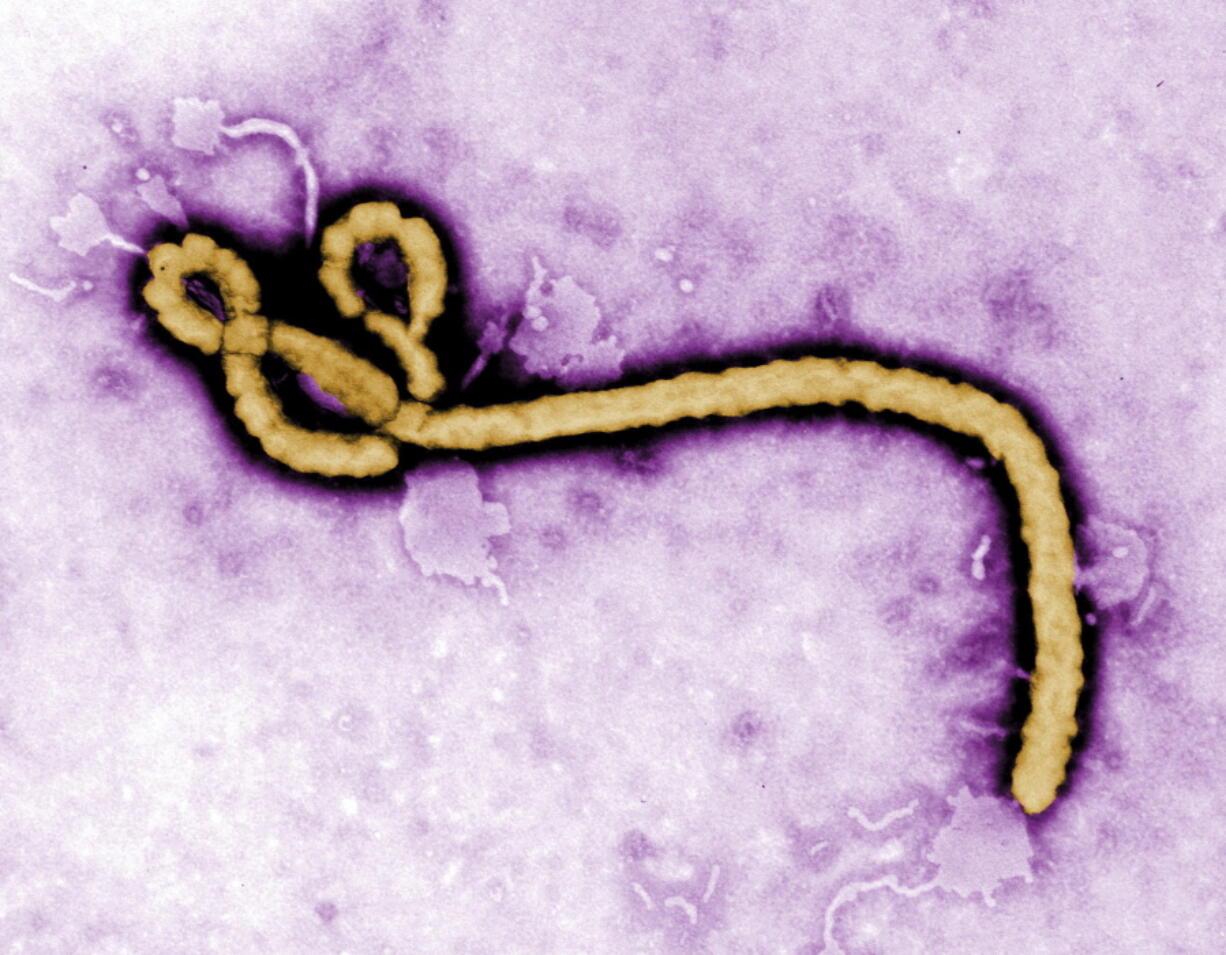 FILE - In this undated colorized transmission electron micrograph file image made available by the CDC shows an Ebola virus virion. Congo’s Ebola outbreak has spread to a city, the capital of the northwestern Equateur province, a worrying shift as the risk of infection is more easily passed on in densely populated urban areas.