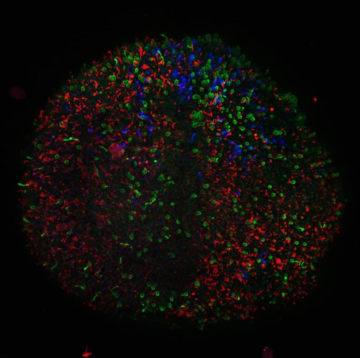 Magnified image of the oganoid retinal tissue, showing photoreceptors that allow people to see color.