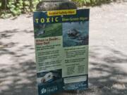 A sign in the Vancouver Lake Regional Park parking lot warns against allowing pets inside the lake, which has had E. coli and blue-green algae health advisories the past few weeks.