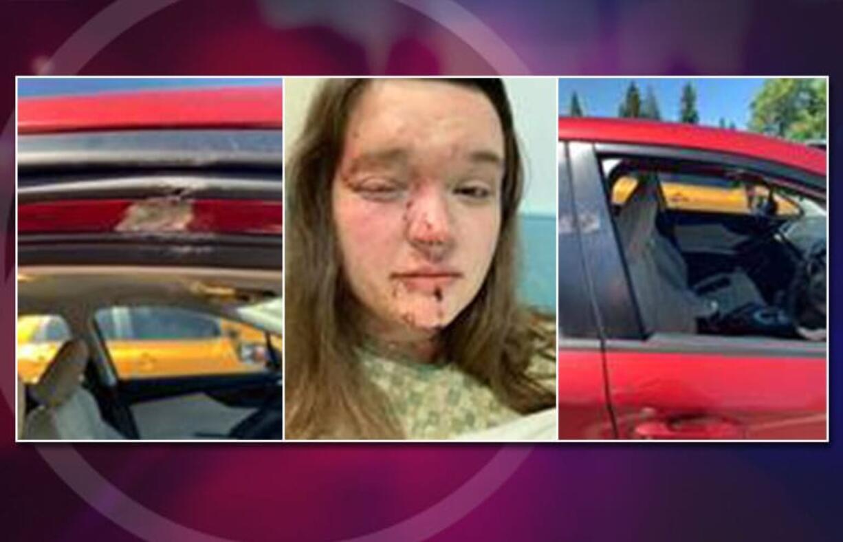 Washington State Patrol detectives are seeking information about a bizarre shooting case in which a bullet struck a car on eastbound state Highway 14 in Vancouver and injured the driver.