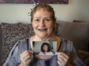 Debra Buckley poses for a portrait as she holds a photo of herself from 1992, which shows her smile prior to dental infections, at her home in Vancouver. Buckley needs to raise $15,000 more to afford dental work that could prevent deadly infections, but she can’t work because of her medical complications and might not ever be able to afford the treatment.