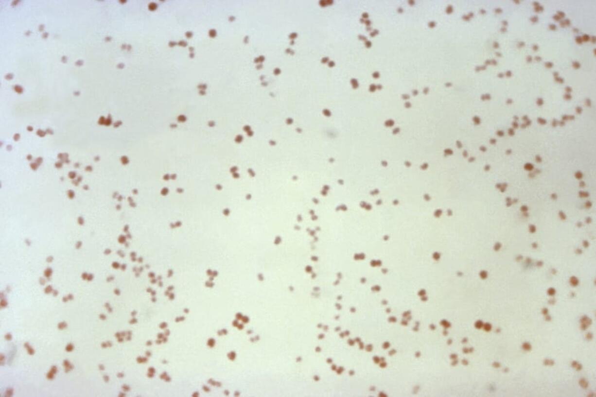 This 1971 microscope image made available by the Centers for Disease Control and Prevention shows Neisseria gonorrhoeae bacteria, which causes the sexually transmitted disease gonorrhea. In a report released Wednesday, Nov. 13, 2019, the Centers for Disease Control and Prevention estimated about 36,000 Americans died from drug-resistant infections in 2017 -- down about 18% from an estimated 44,000 in 2013. Though deaths may be going down, non-fatal infections increased nationally from 2013 to 2017, from 2.6 million to 2.8 million. Dramatic increases in drug-resistant gonorrhea, urinary tract infections, and group A strep were largely to blame.