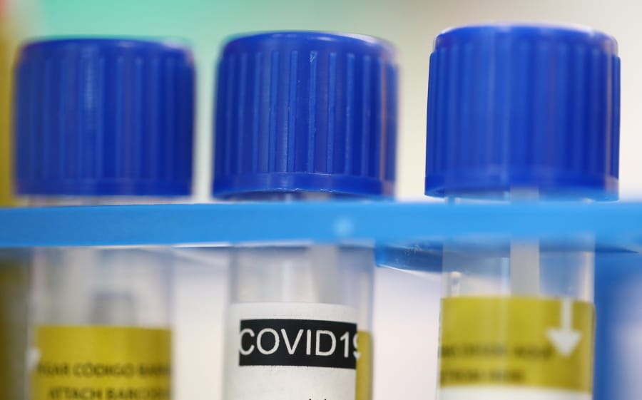 Tube tests stands in a holder as media visit the Microbiology Laboratory of the University Hospital, CHUV, during the coronavirus disease (COVID-19) outbreak in Lausanne, Switzerland, Monday, March 23, 2020. The Swiss authorities proclaimed on March 16, a state of emergency in an effort to halt the spread of the coronavirus and Covid-19 disease. The government declared that all entertainment and leisure businesses will shut down. Grocery stores, and hospitals will remain open and new border controls will be put in place.