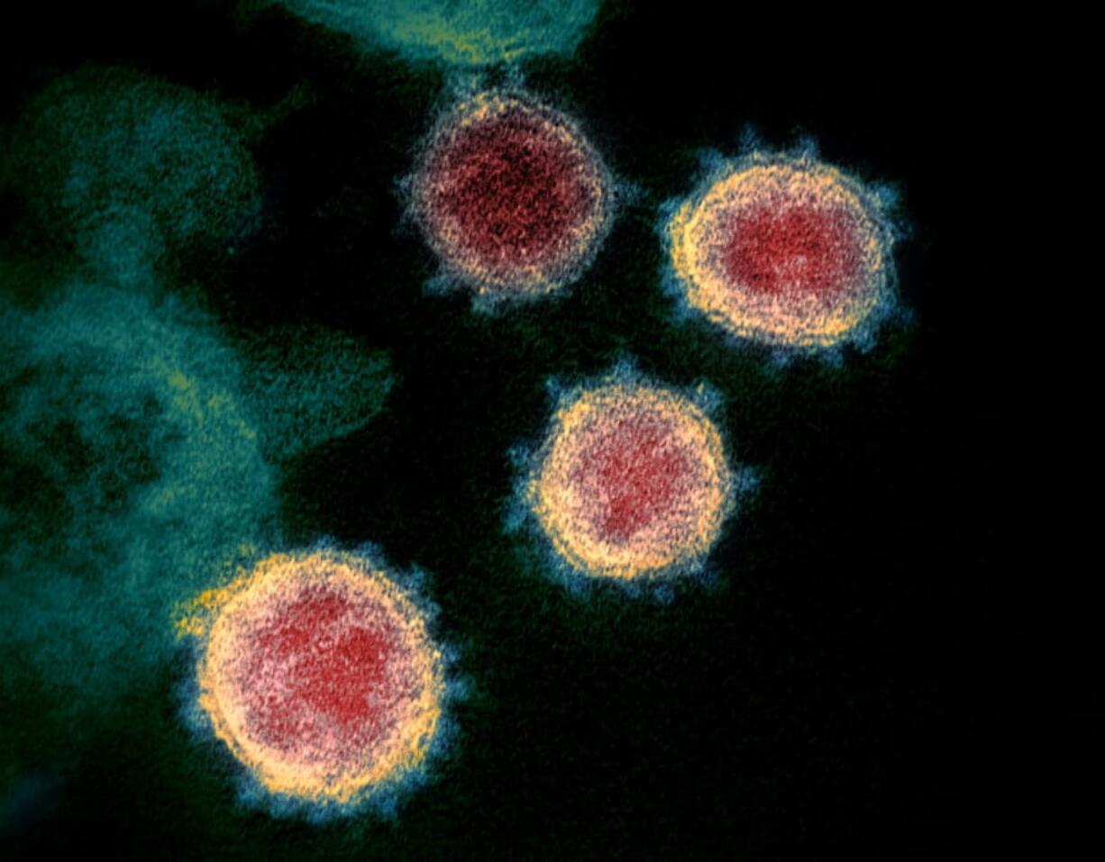 This undated electron microscope image made available by the U.S. National Institutes of Health in February 2020 shows the coronavirus that causes COVID-19. The sample was isolated from a patient in the U.S.