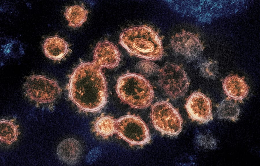 This 2020 electron microscope image provided by the National Institute of Allergy and Infectious Diseases — Rocky Mountain Laboratories shows SARS-CoV-2 virus particles isolated from a patient in the U.S., emerging from the surface of cells cultured in a lab.