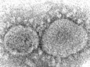 This 2020 electron microscope image made available by the Centers for Disease Control and Prevention shows SARS-CoV-2 virus particles which cause COVID-19. According to research released in 2021, evidence is mounting that having COVID-19 may not protect against getting infected again with some of the new variants. People also can get second infections with earlier versions of the coronavirus if they mounted a weak defense the first time. (Hannah A.