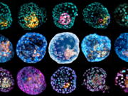 This undated combination of microscope images provided by Monash University in March shows different &quot;iBlastoids&quot; (embryolike structures) stained to highlight different cell types.