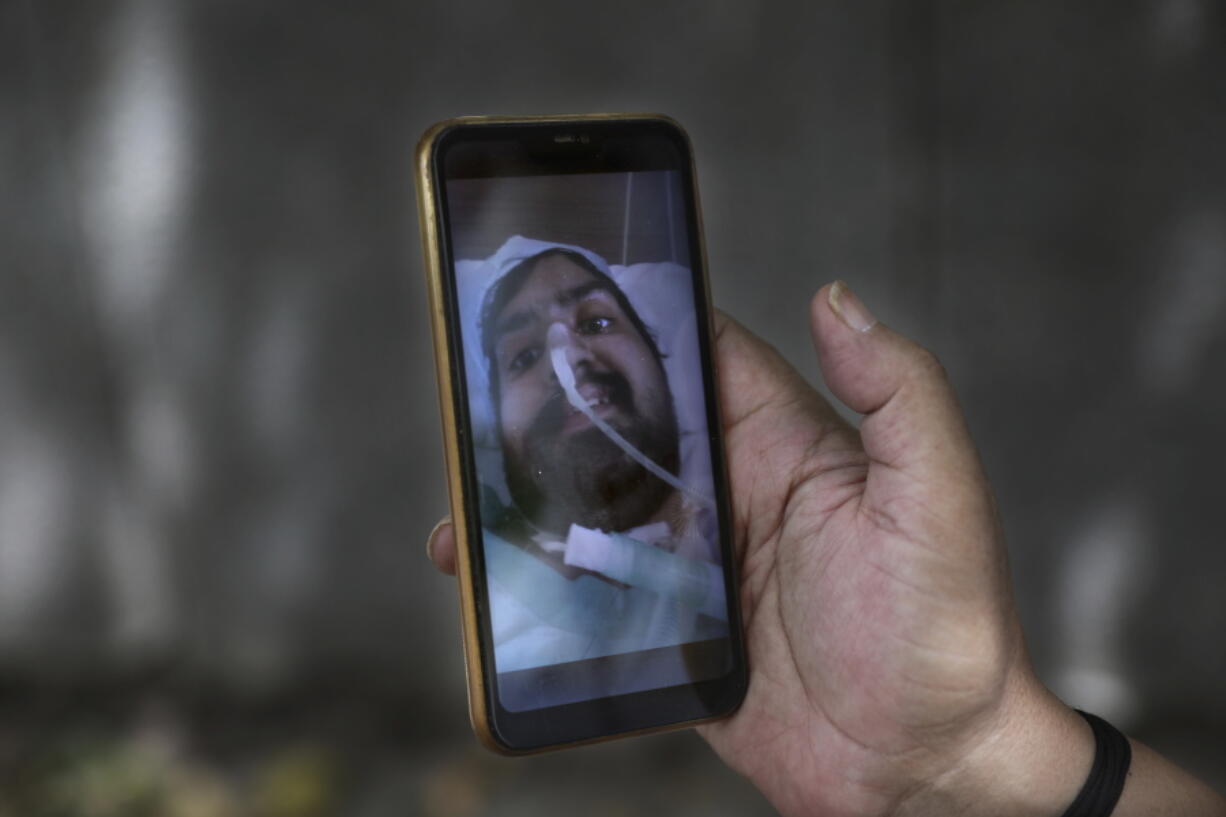 Anil Sharma shows a photograph of his son Saurav who is being treated for COVID-19 at a private hospital in New Delhi, India, Thursday, July 1, 2021. Life is tentatively returning to normal in India as coronavirus cases fall. But millions are embroiled in a nightmare of huge piles of medical bills. Most Indians don't have health insurance and costs for COVID-19 treatment have them drowning in debt.