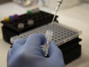 A lab specialist manually pipettes a mix for coronavirus testing.