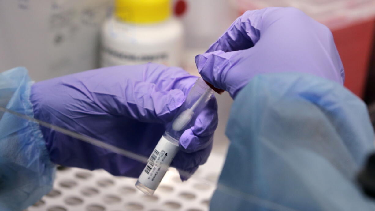 FILE - James Robson, a biomedical engineering graduate student, holds a swab and specimen vial in the new COVID-19, on-campus testing lab, Thursday, July 23, 2020, at Boston University in Boston. The United States has improved its surveillance system for tracking new coronavirus variants such as omicron, boosting its capacity by tens of thousands of samples since early 2021.