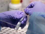 FILE - James Robson, a biomedical engineering graduate student, holds a swab and specimen vial in the new COVID-19, on-campus testing lab, Thursday, July 23, 2020, at Boston University in Boston. The United States has improved its surveillance system for tracking new coronavirus variants such as omicron, boosting its capacity by tens of thousands of samples since early 2021.