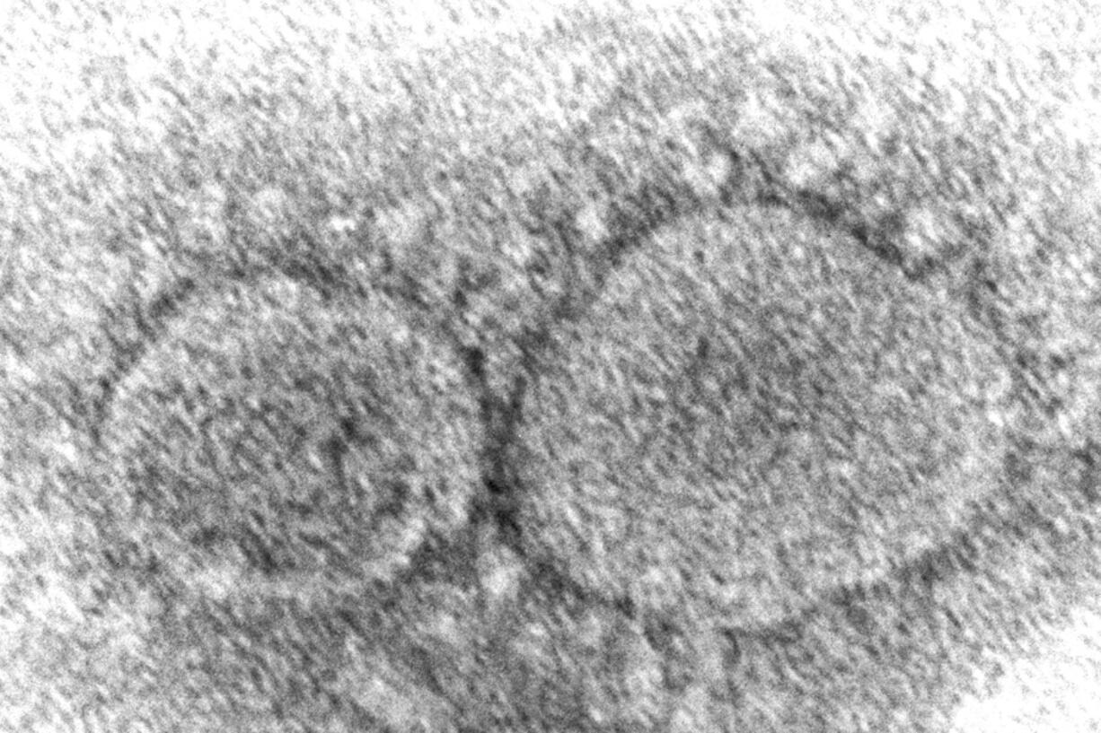 FILE - This 2020 electron microscope image made available by the Centers for Disease Control and Prevention shows SARS-CoV-2 virus particles which cause COVID-19. The World Health Organization has appointed an independent scientific panel to advise on whether vaccine shots need reformulating because of omicron or any other mutant. (Hannah A.