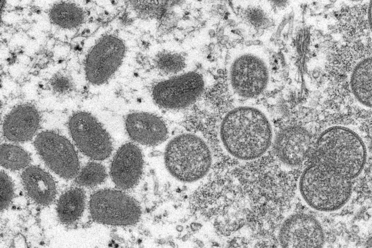 FILE - This 2003 electron microscope image made available by the Centers for Disease Control and Prevention shows mature, oval-shaped monkeypox virions, left, and spherical immature virions, right, obtained from a sample of human skin associated with the 2003 prairie dog outbreak. WHO's top monkeypox expert Dr. Rosamund Lewis said she doesn't expect the hundreds of cases reported to date to turn into another pandemic, but acknowledged there are still many unknowns about the disease, including how exactly it's spreading and whether the suspension of mass smallpox immunization decades ago may somehow be speeding its transmission. (Cynthia S.