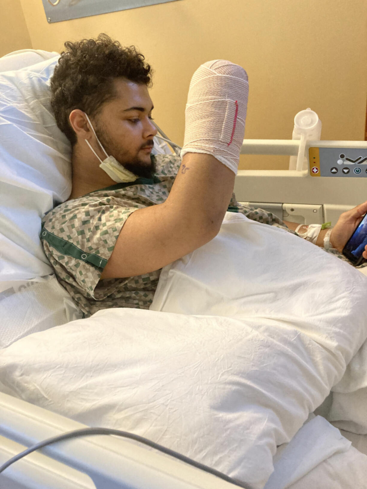 Maderious Cash in a hospital after having his right hand amputated from a fireworks accident. His grandfather said Cash was holding a firework and didn't mean to light it when it exploded in his hand.