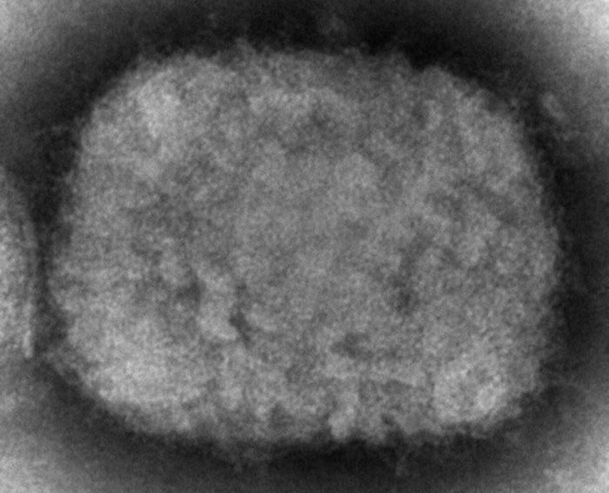 FILE - This 2003 electron microscope image made available by the U.S. Centers for Disease Control and Prevention shows a monkeypox virion, obtained from a sample associated with the 2003 prairie dog outbreak. Two children have been diagnosed with monkeypox in the United States: a toddler in California and an infant who is not a U.S. resident, health officials said Friday, July 22, 2022. (Cynthia S.