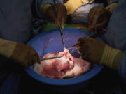 In this photo provided by NYU Langone Health, surgeons prepare a genetically modified pig heart for transplant into a recently deceased donor at NYU Langone Health on Wednesday, July 6, 2022, in New York. Experiments are raising new hope that pigs might one day help fill a shortage of donated organs -- at least, for people who need a new heart or kidney.