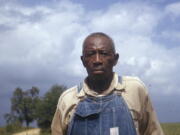 This 1950's photo made available by the National Archives shows a man included in a syphilis study in Alabama. For 40 years starting in 1932, medical workers in the segregated South withheld treatment for Black men who were unaware they had syphilis, so doctors could track the ravages of the illness and dissect their bodies afterward.