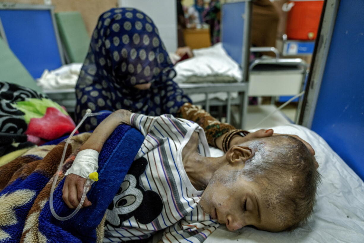 FILE - A mother holds her malnourished boy at the Indira Gandhi hospital in Kabul, Afghanistan, Sunday, May 22, 2022. U.N. humanitarian chief Martin Griffiths told the U.N. Security Council on Monday, Aug. 30, 2022, that Afghanistan faces deepening poverty with 6 million people at risk of famine as he urged donors to immediately provide $770 million to help Afghans get through the winter.