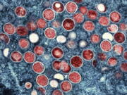 FILE - This image provided by the National Institute of Allergy and Infectious Diseases (NIAID) shows a colorized transmission electron micrograph of monkeypox particles (red) found within an infected cell (blue), cultured in the laboratory that was captured and color-enhanced at the NIAID Integrated Research Facility (IRF) in Fort Detrick, Md. With monkeypox cases subsiding in Europe and parts of North America in 2022, many scientists say now is the time to prioritize stopping the virus in Africa.